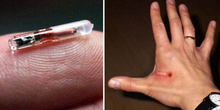Microchip sotto pelle: realtà o fantascienza?